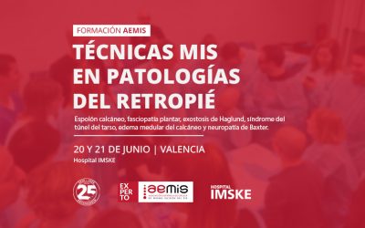 Técnicas MIS en patologías del retropié