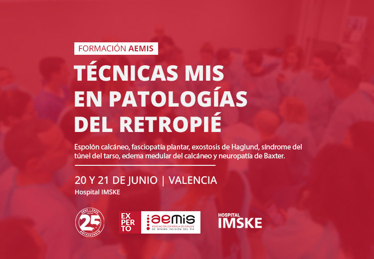 750x520-noticia-aemis